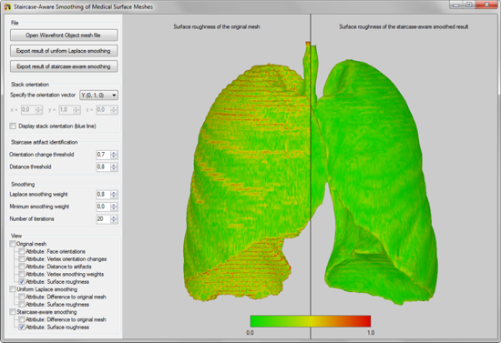 staircase-aware smoothing of medical surface meshes